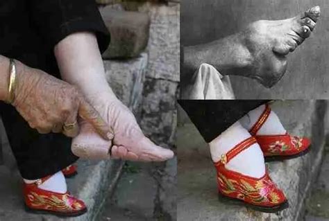 why did foot binding stop